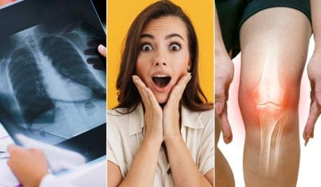 Quiz: Demuestra qué tan bien conoces tu cuerpo
